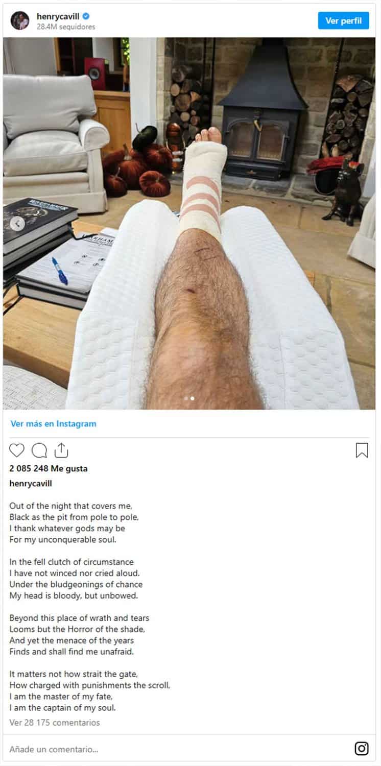 henry cavill lesión