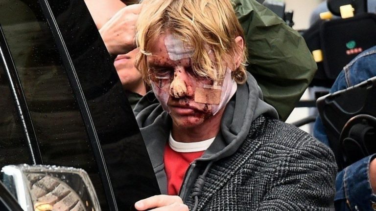 foto del set de clayface